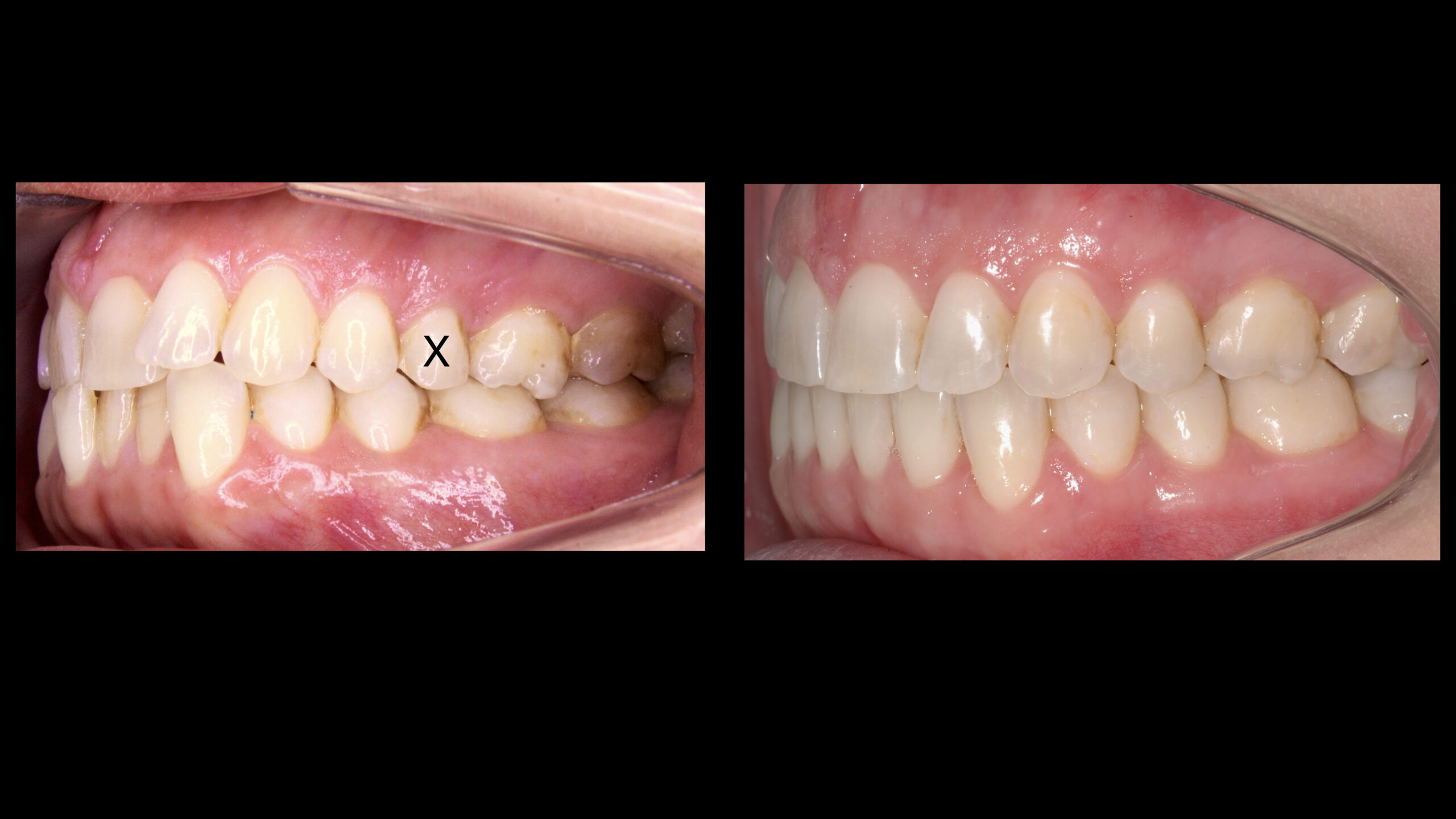 Fotos-finalizacao-.008-1-scaled.jpeg